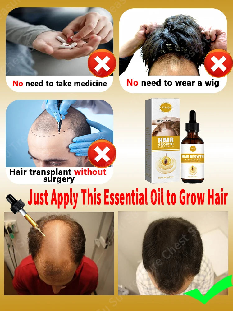 Hair Growth Oil Baldness for men treatment