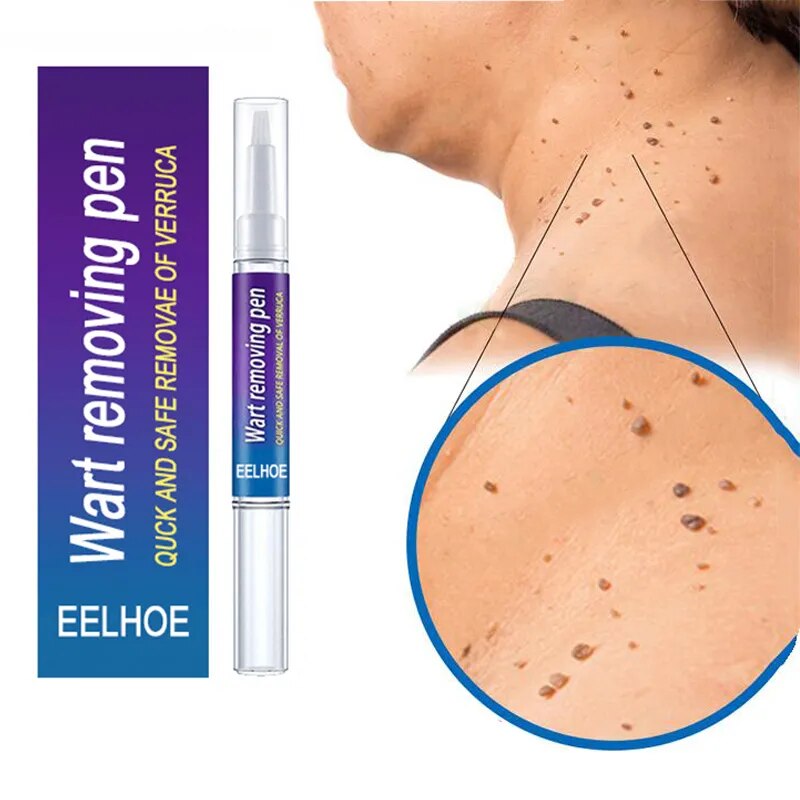 🍀Wart Removal Mole Remedy Liquid Pen Treatment Papillomas Removing Skin Labels Flat Wart Genitals Painless Beauty Herbal Cream