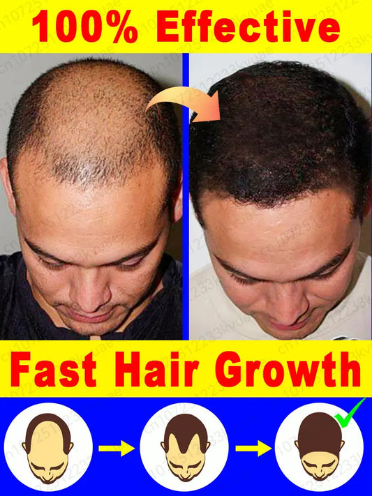 Fast Hair Growth Essence Oil Products Effective Baldness Repair Treatment Anti Hereditary Seborrheic Alopecia Loss For Men Women